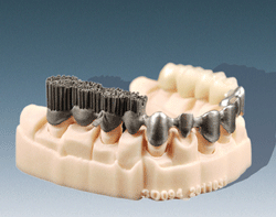 EOS Printed Metal Teeth