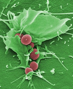 Helmoltz Nanoparticles Fight S. aureus