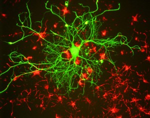 Neuron in Tissue Culture