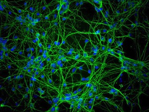 Cerebellar Neurons