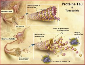 Tau Protein 