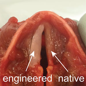 Engineered Vocal Cords
