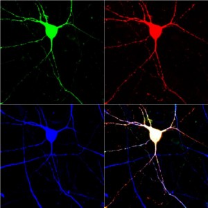 Serotonin Releasing Neurons
