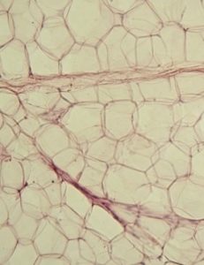 Stem Cells from Adipose Tissue