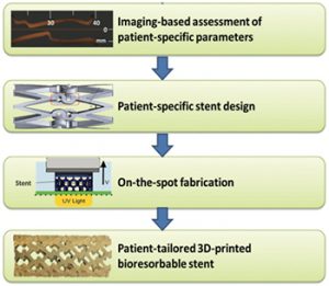 3D Printing Customized Stents 